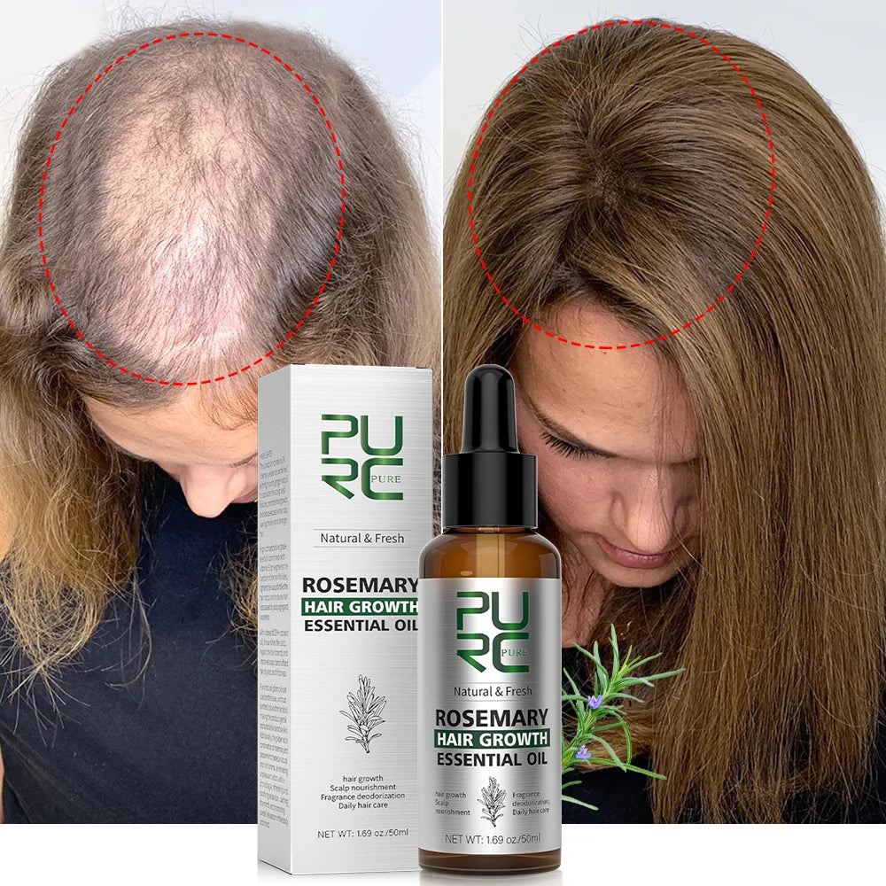 PURC Rosemary Oil Hair Growth for Men Women Fast Growing Products Essential Oils Ginger Anti Hair Loss Scalp Treatment Hair Care